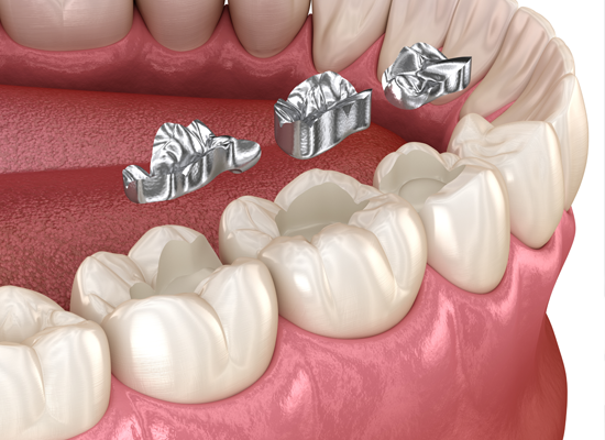 Restorative Dental Materials (SHOFU)