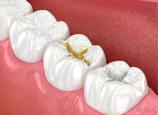 Restorative Dental Materials (SHOFU)