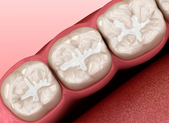 Restorative Dental Materials (SHOFU)